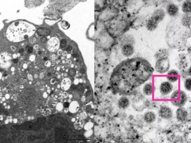 Objavljena fotografija soja omikron