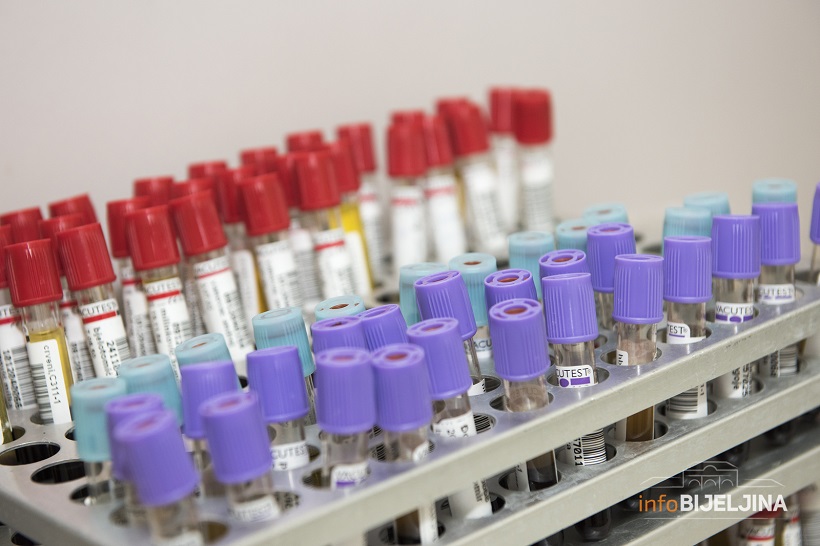 Sa zarazom se nije izborilo 11 pacijenata: Korona virus utvrđen kod još 37 ljudi u Srpskoj