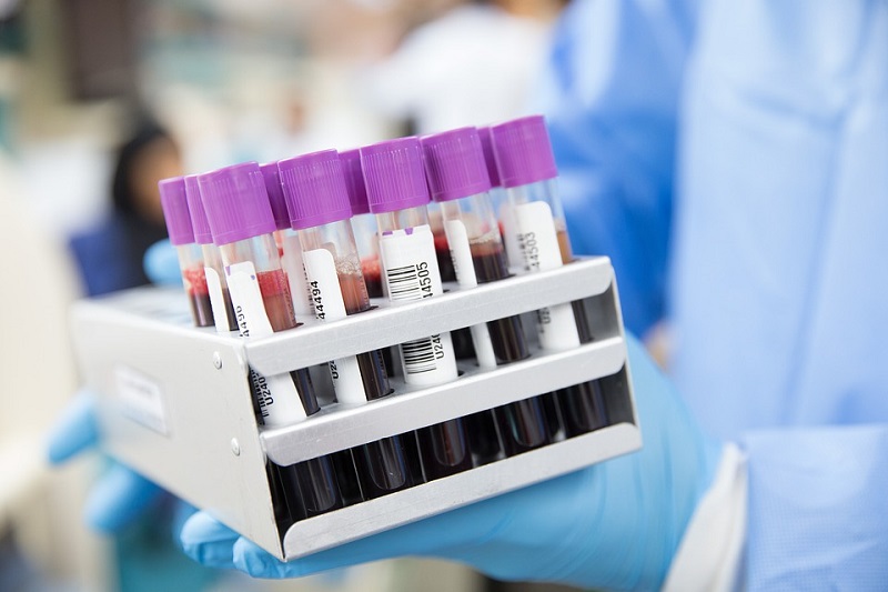  Na virus korona pozitivno još devet građana, preminulo pet zaraženih
