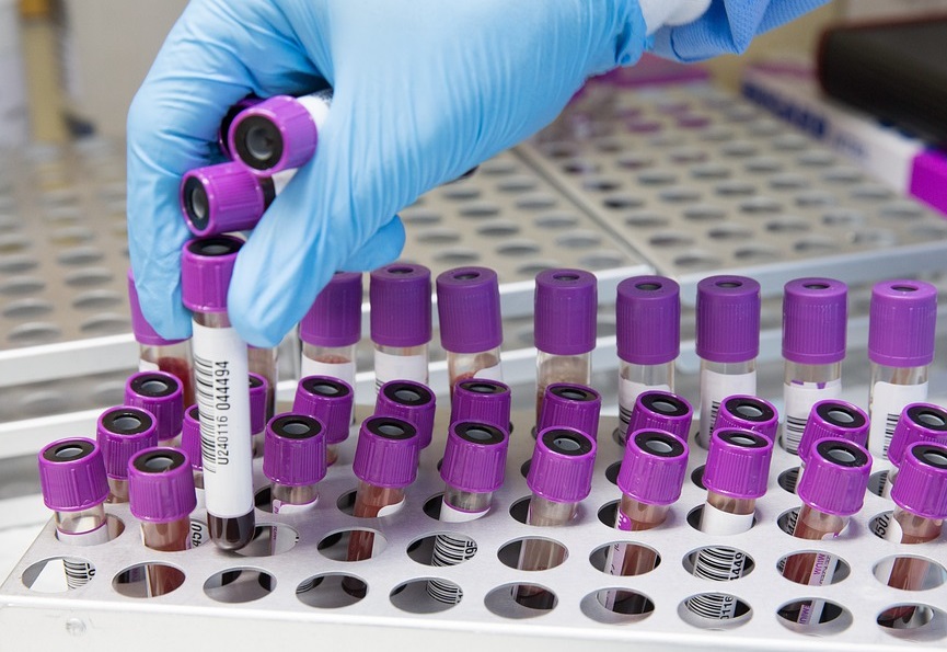 Korona virus potvrđen kod još 39 osoba u Srpskoj, preminulo 17 pacijenata