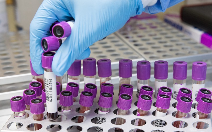 Koronom zaraženo još pet osoba: Bez smrtnih slučajeva u Srpskoj