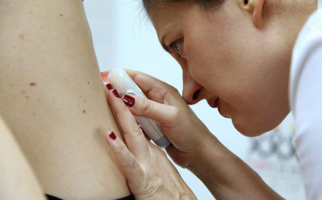 Besplatni pregledi kože na bijeljinskom Gradskom trgu