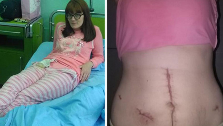 Porodilja u čijem stomaku su ljekari ostavili dva metra gaze: Zdravlje mi je uništeno, tražim da kazne odgovorne