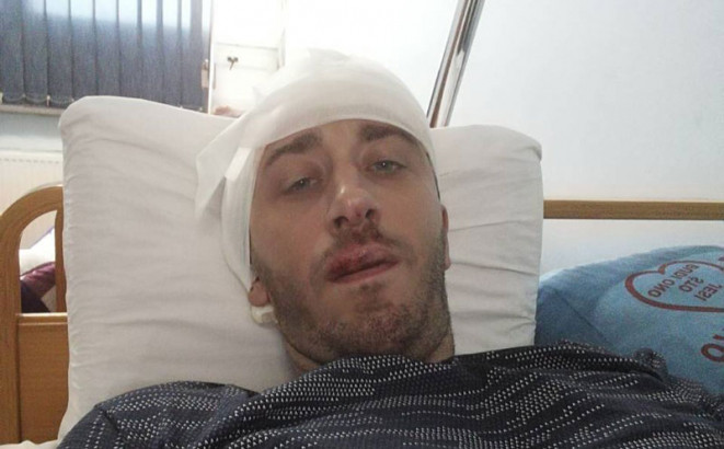 Pretučeni novinar Vladimir Kovačević pušten na kućno liječenje