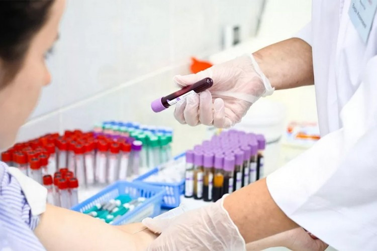 U Srpskoj za godinu dana 10 novooboljelih od HIV/AIDS-a