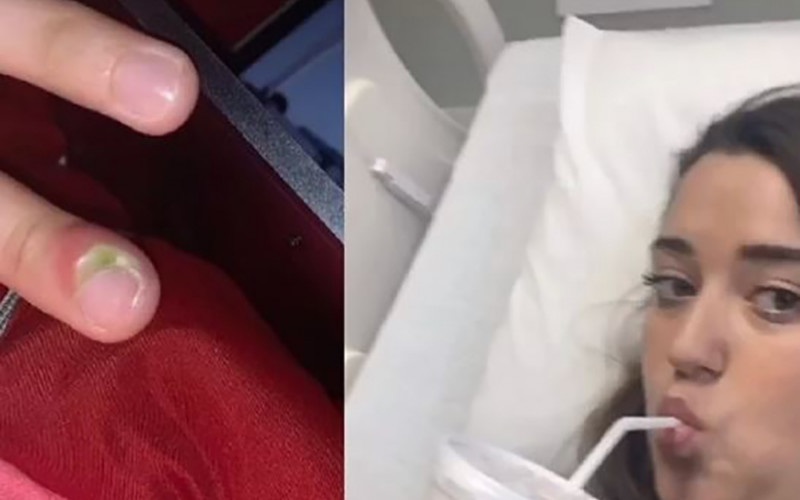 Djevojka je godinama grickala nokte, zbog čega joj je umalo AMPUTIRAN prst