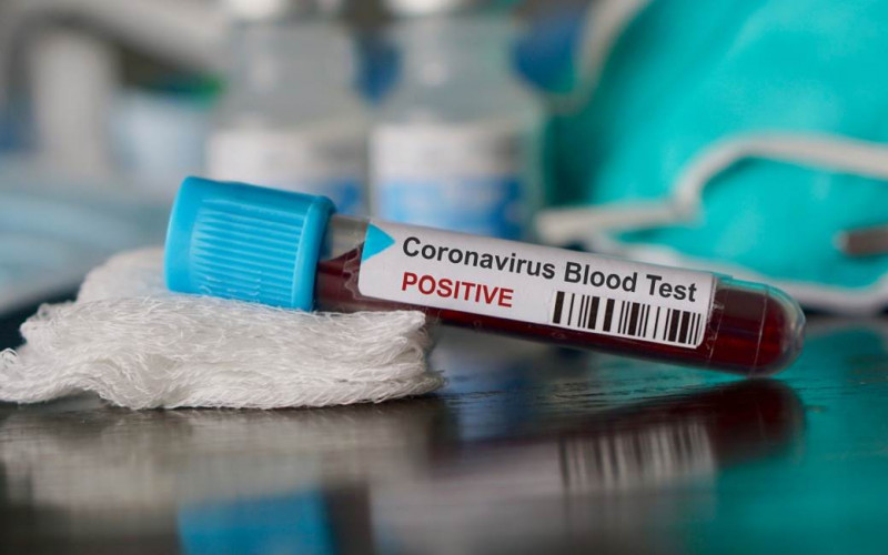 Savjeti SZO: Kako da razlikujete virus korona od običnog gripa?