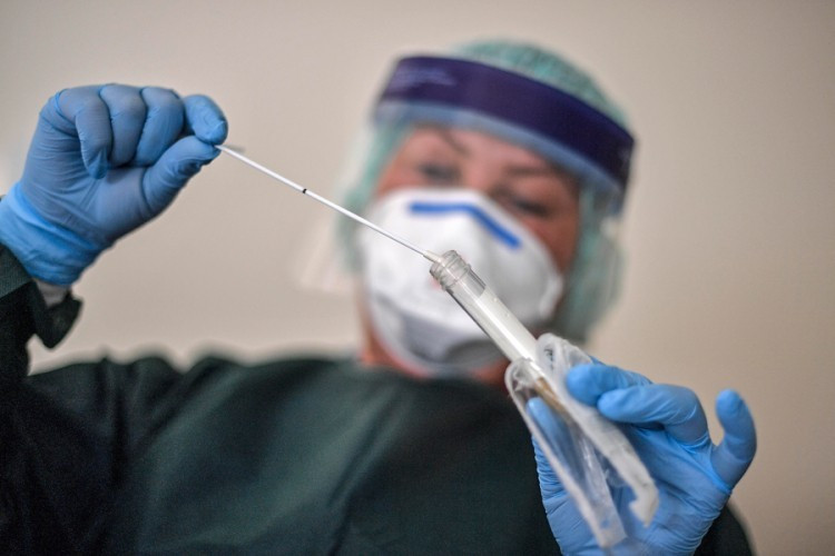 Nema novih slučajeva virusa korona u Srpskoj