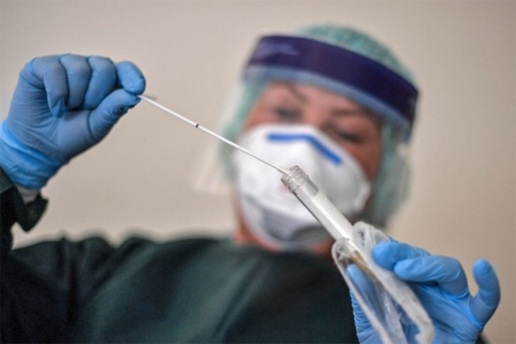 Sedam novih slučajeva virusa korona u Srpskoj