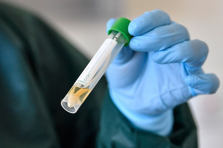 Prva dva slučaja virusa u Brčkom