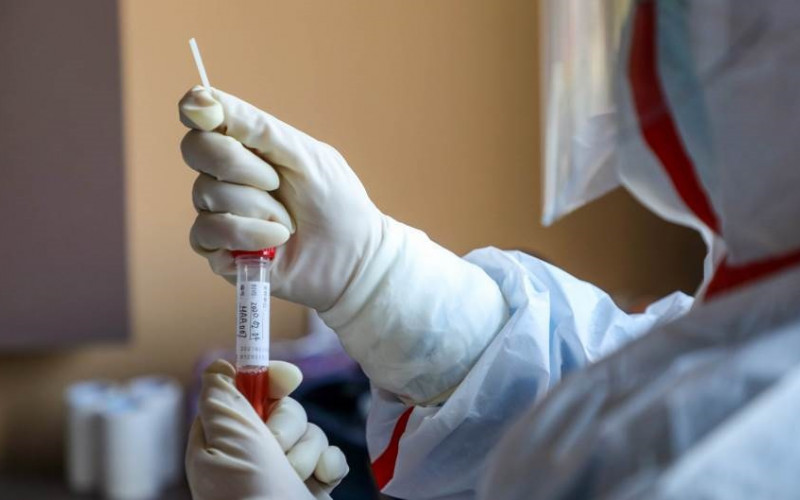 Registrovana 54 nova slučaja koronavirusa u Srbiji, više od 300 oboljelih