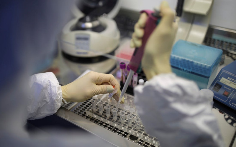 Dogovorena nabavka 25.000 testova na virus korona