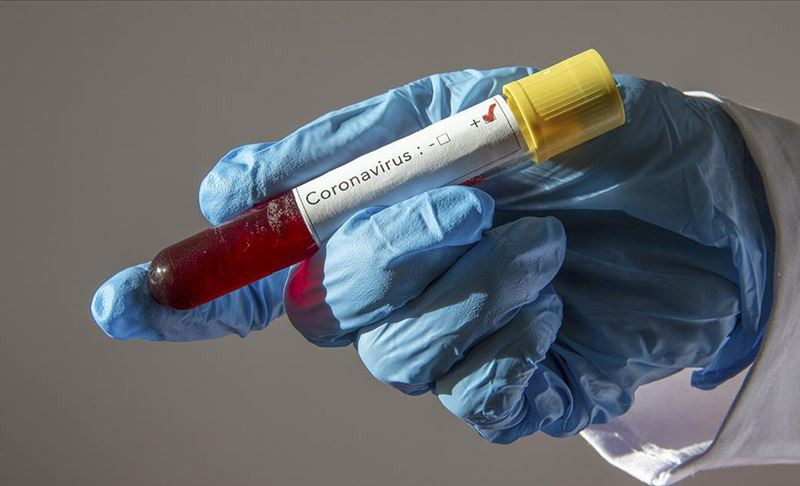 Testirane 202 osobe na virus korona u FBiH, 29 pozitivno
