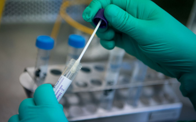 11 novozaraženih virusom korona u Srpskoj