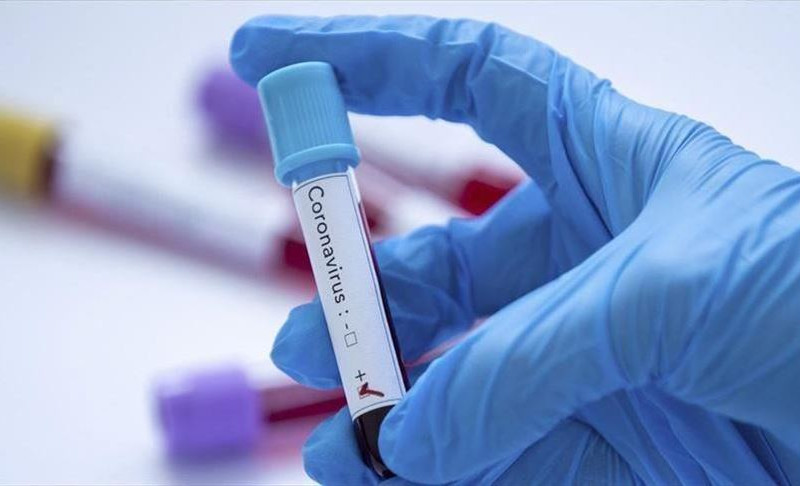 U Srpskoj još 28 osoba pozitivno na korona virus