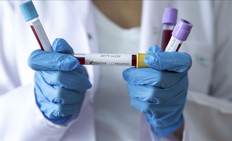 Cijena komercijalnog testa na korona virus 200 KM: Testiranje u Srpskoj jeftinije u odnosu na region?