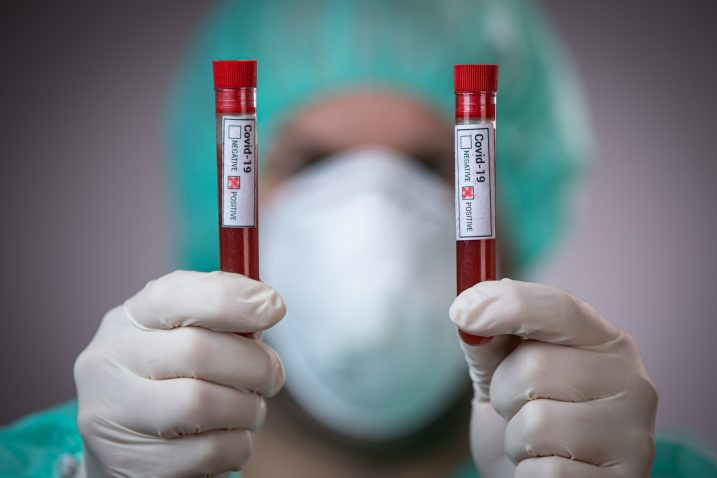 U Srpskoj 71 osoba pozitivna na virus korona