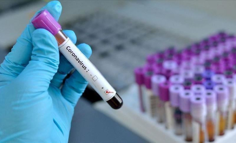 U Srpskoj još 42 osobe pozitivne na virus korona: Dvoje zaraženih iz Bijeljine