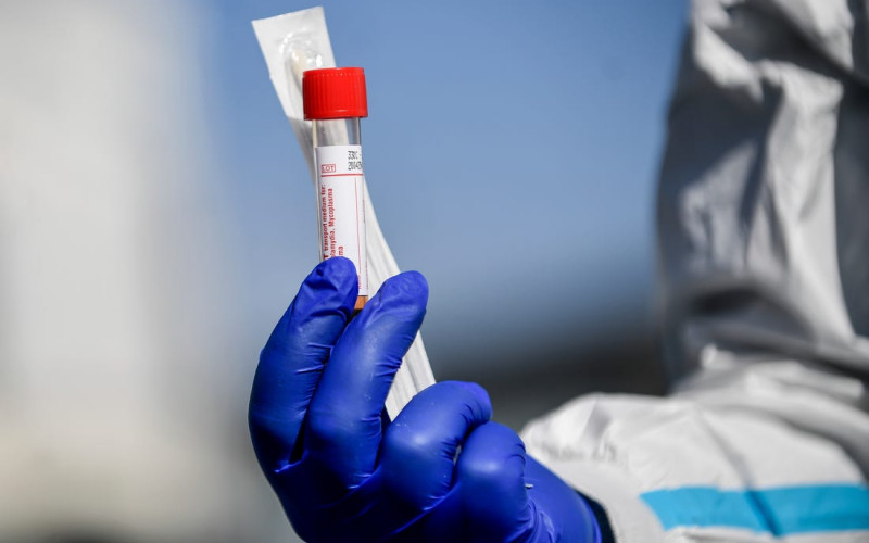 Zašto je trećina testova na antitijela na koronu lažno negativna?