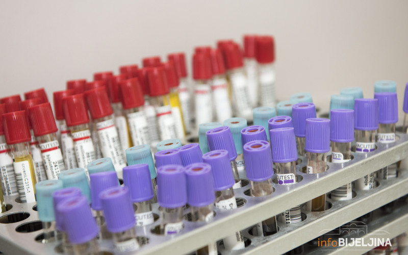 Šta nam govore rezultati seroloških ispitivanja na virus korona?