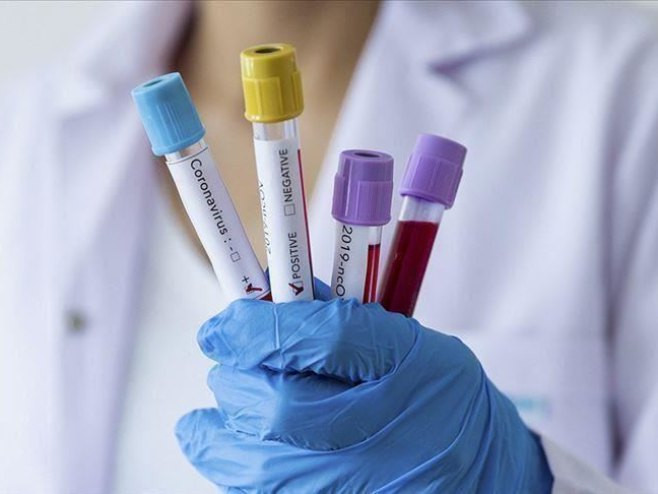 U Srpskoj na virus korona pozitivno 97 osoba