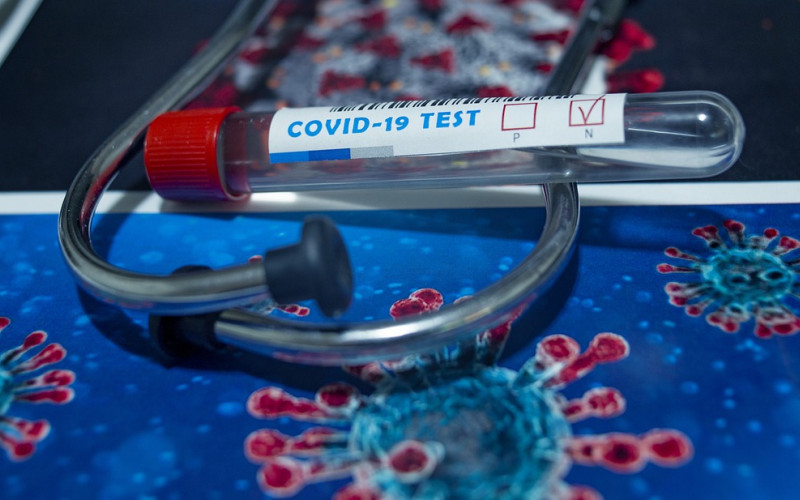 U Republici Srpskoj 70 novozaraženih