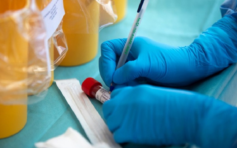 U RS 88 novozaraženih koronom, preminula dva muškarca