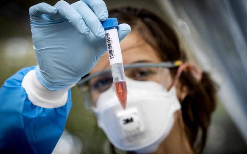 Korona virus potvrđen kod još 141 osobe u Srpskoj, preminula tri pacijenta