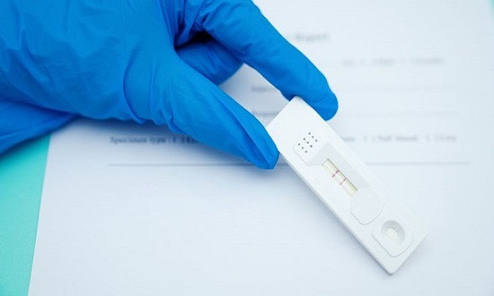 OTKRIVAJU KORONU ZA POLA SATA Novi antigenski testovi su jeftiniji i imaju preciznost od 97 odsto