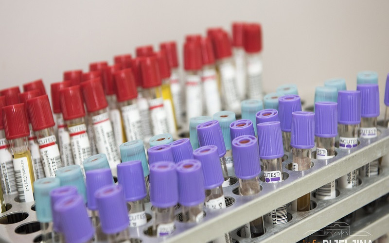 PREMINULA 23 OBOLJELA Korona virusom zaraženo još 609 osoba u Srpskoj