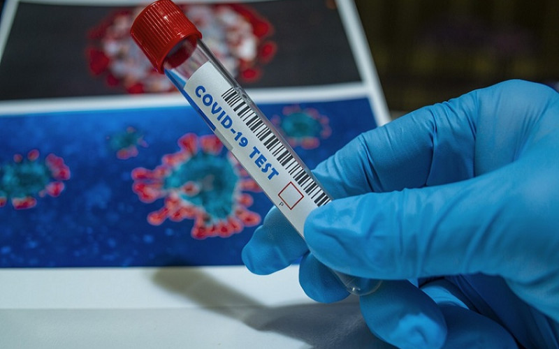 Virus korona potvrđen kod 387 оsоba u RS, 26 smrtnih slučajeva