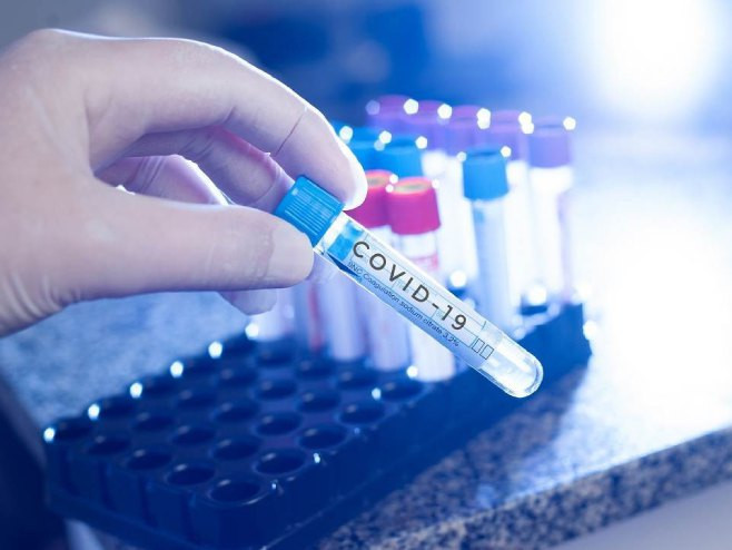 Još 384 oboljelih u Srpskoj, preminulo 27 osoba zaraženih koronom