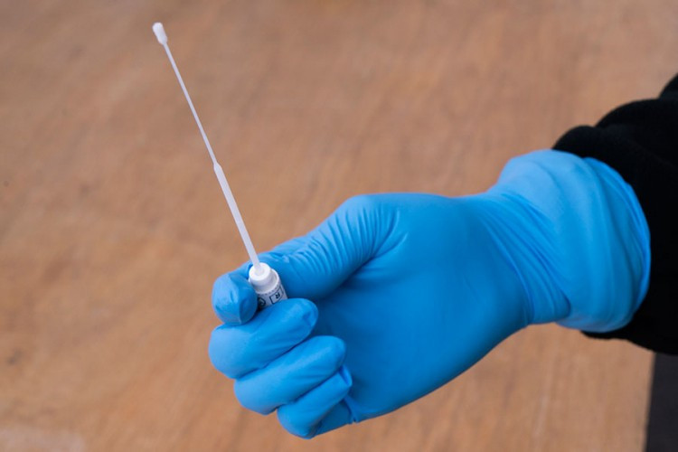 U RS 374 nova slučaja korone, 25 preminulih