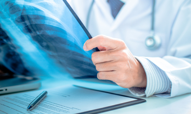 Za sedam dana 28 oboljelih od teške respiratorne infekcije u Srpskoj