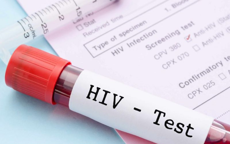 U RS tokom godine registrovan jedan slučaj HIV-a, tri osobe preminule