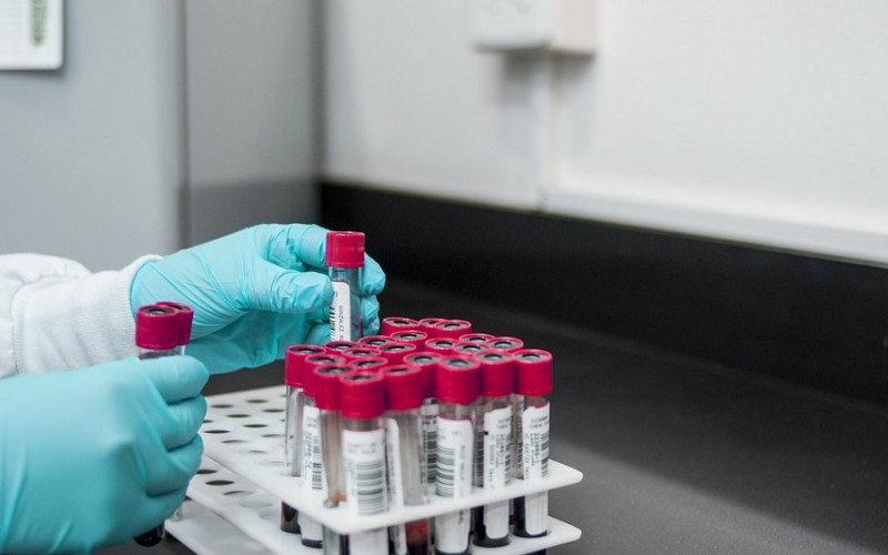 U Srpskoj još 97 ljudi pozitivno na korona virus, 14 osoba preminulo