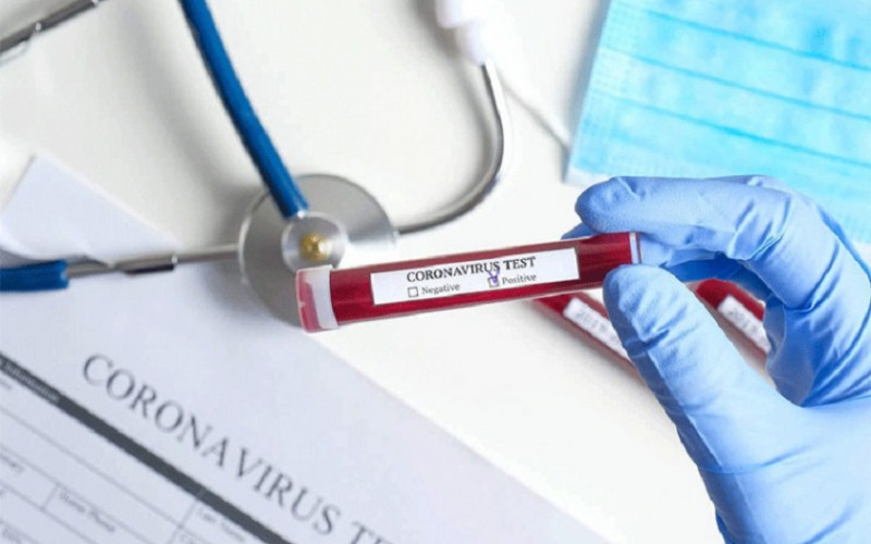 Za komercijalno testiranje u Srpskoj potrebno se naručiti pet do šest dana ranije