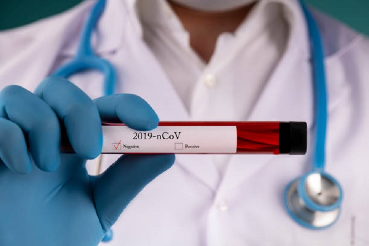 U Srpskoj jedna žena zaražena koronom, bez smrtnog slučaja u protekla 24 sata