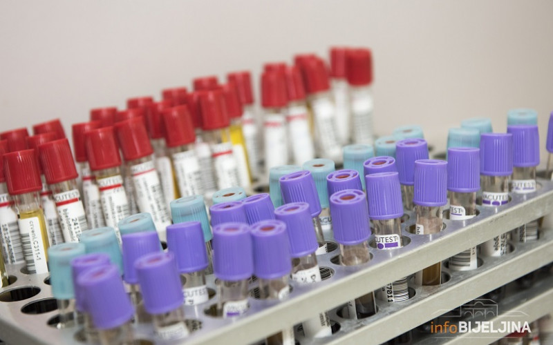 Prijavljeno devet smrtnih slučajeva u RS, četiri žene pozitivne na virus korona