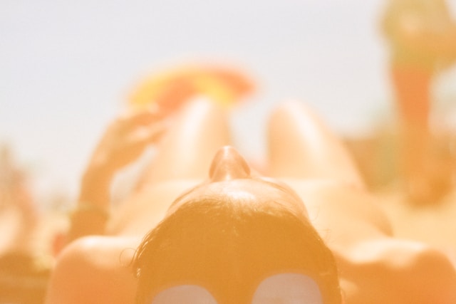Koža pamti sunce: Ljekari otkrivaju kako na vrijeme prepoznati melanom