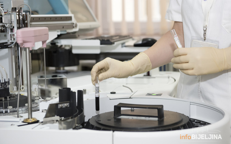 U Srpskoj preminulo šest osoba, zaraženo još 537