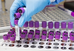 Korona virus potvrđen kod još 39 osoba u Srpskoj, preminulo 17 pacijenata