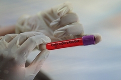 EU razvila PCR test specifičan za omikron