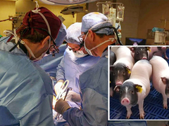 Svinjsko plućno krilo uspješno presađeno kod čovjeka