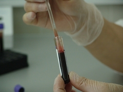 Epidemiološka situacija sve gora: U Srpskoj detektovan delta soj