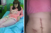Porodilja u čijem stomaku su ljekari ostavili dva metra gaze: Zdravlje mi je uništeno, tražim da kazne odgovorne