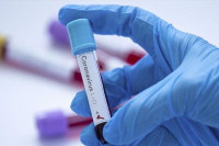 U Srpskoj još 28 osoba pozitivno na korona virus