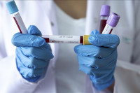 Cijena komercijalnog testa na korona virus 200 KM: Testiranje u Srpskoj jeftinije u odnosu na region?