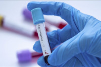 Od korona virusa preminula još dva pacijenta