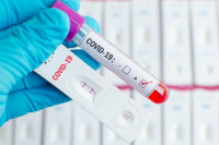 Brži rezultati odagnali neizvjesnost kod građana Semberije